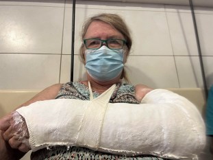 janine's broken wrist